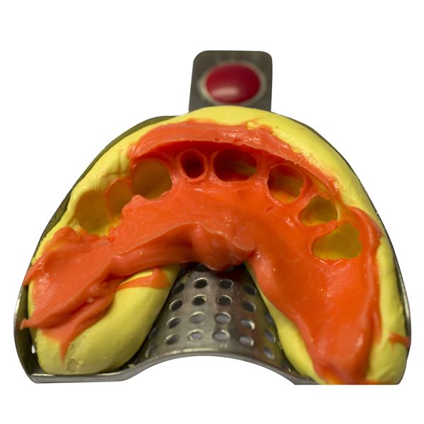 Stomaflex putty/solid/ 1300g