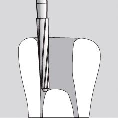 Vrtáčik Endo-Z TC 22/016  142515267