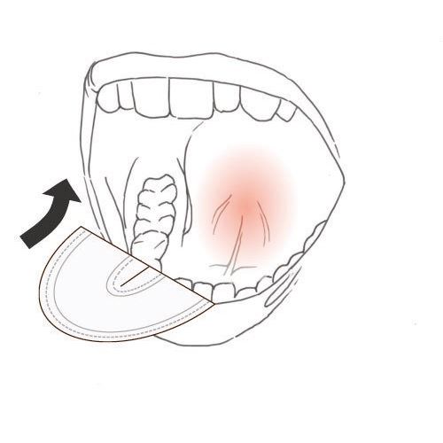 DryDent Parotid -tvár veľ. L .50 ks