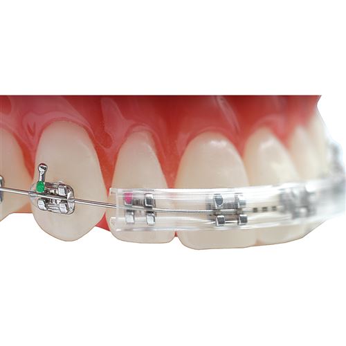 Morgan bumper chránič - číry 5x30 cm