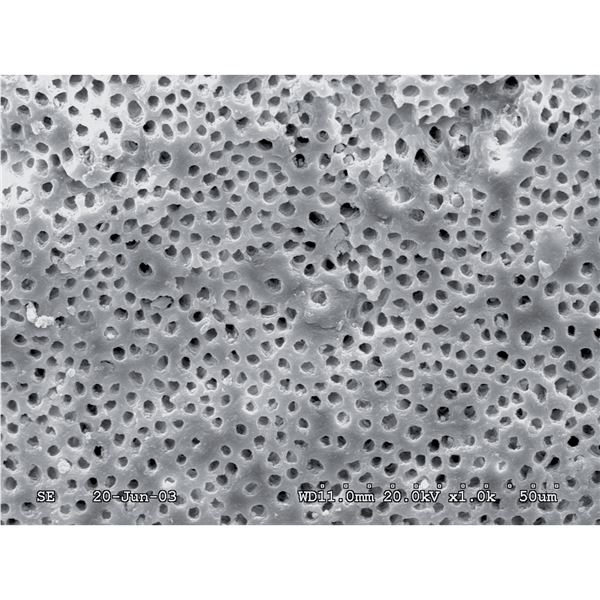 EDTA 18%  30 ml