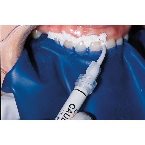 OraSeal tmel 4x1,2 ml