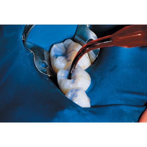 UltraSeal XT Plus op. biela 20 x 1,2 ml