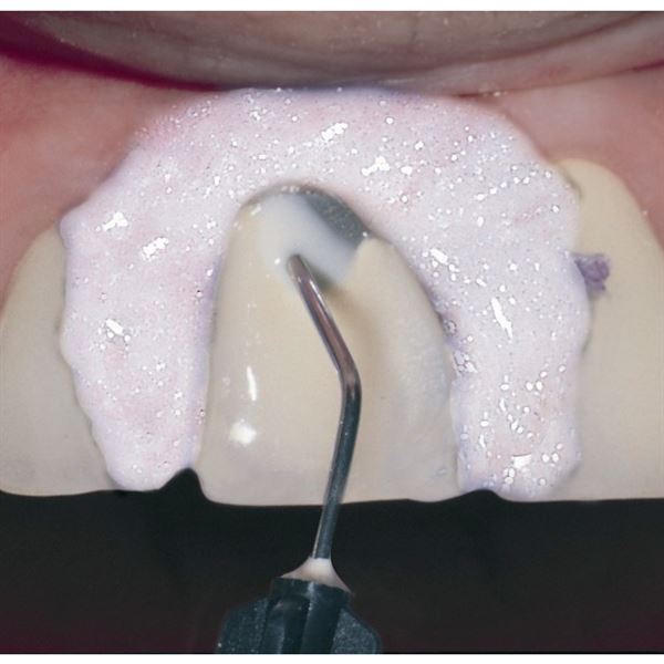 PermaFlo 2x1,2 ml dentín-opaquer
