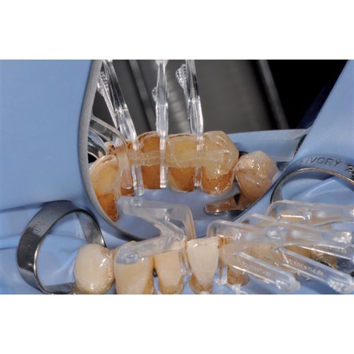 Clip&Splint spony 30 ks