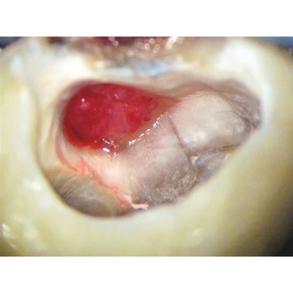 Biodentine 5 x 0,7g 