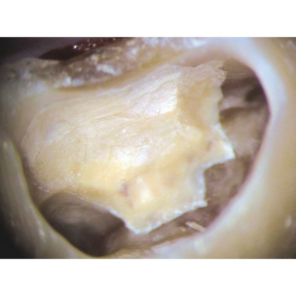Biodentine 5 x 0,7g 