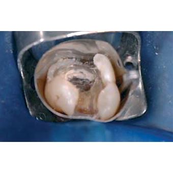 Biodentine 5 x 0,7g 
