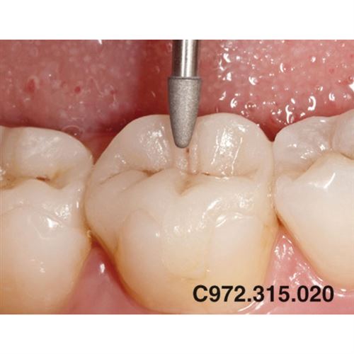 Occlusal Shaper ED C972.315.020 žlté