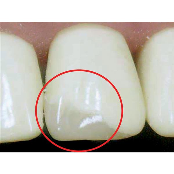 CoForm náhr. 8ks  41-42M