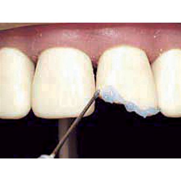 CoForm náhr. 8ks  41-42M