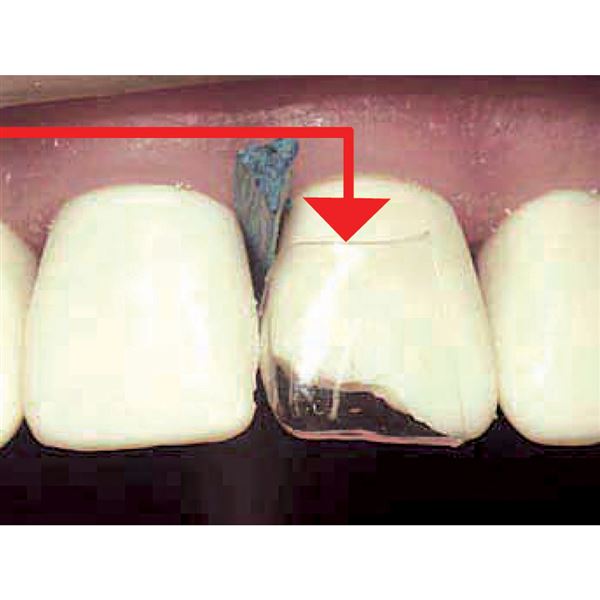 CoForm náhr. 8ks  41-42M