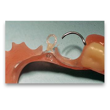 Fast Splint splietaný vrkôčik ružový 1,0x150mm, 2ks
