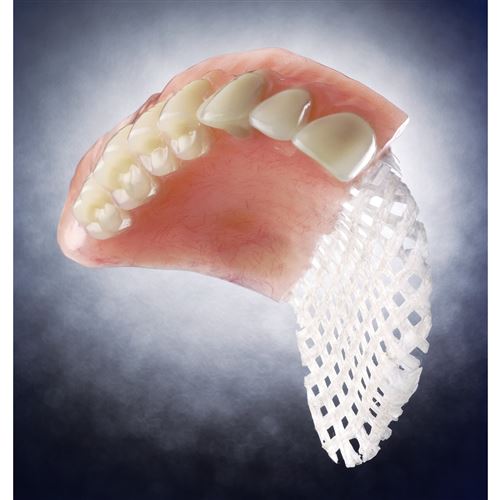 Fast Splint mriežka 80x53 mm 2ks
