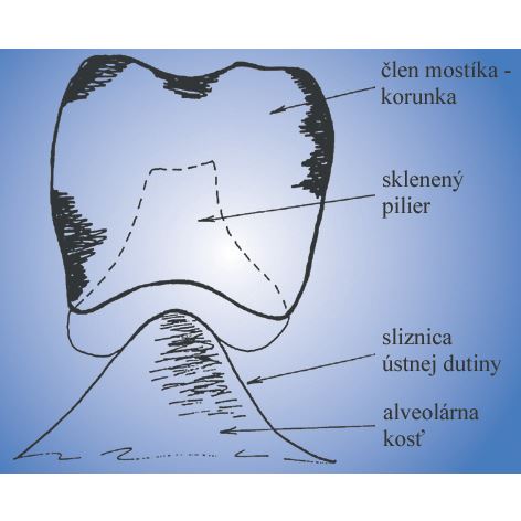 ZX-27 sklenený pilier S