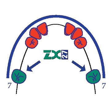 ZX-27 sklenený pilier S