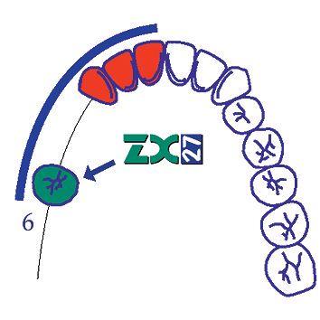 ZX-27 sklenený pilier S