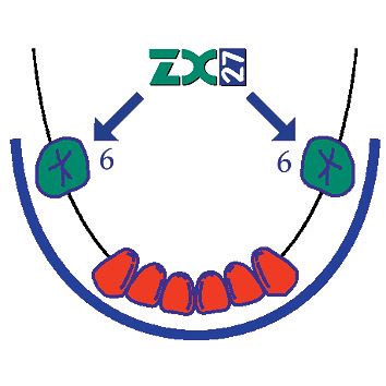 ZX-27 sklenený pilier S