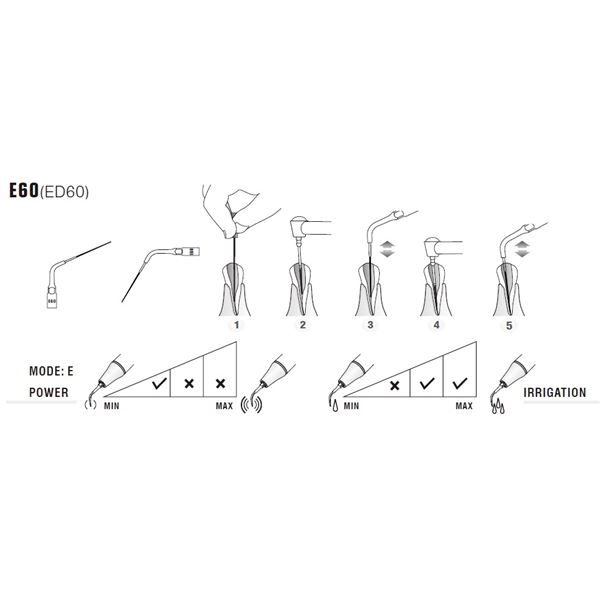 Woodpecker-DTE endo tip ED60
