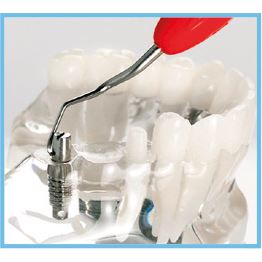 LM  kyreta mini Implant Universal ErgoMix  283-284MTIEM