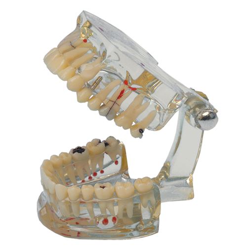 Študijný model Transparent Plus