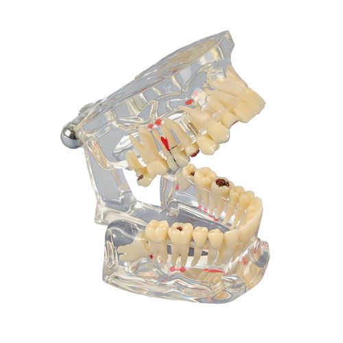 Študijný model Transparent de Luxe