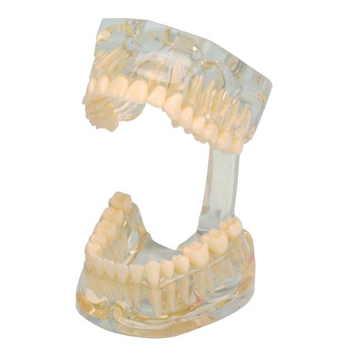 Študijný model Transparent