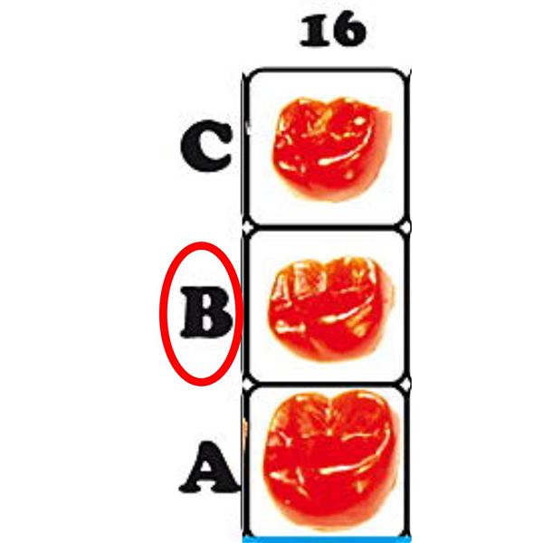 Fazetové prvky 16B - 12.6016