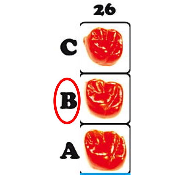 Fazetové prvky 26B - 12.6027