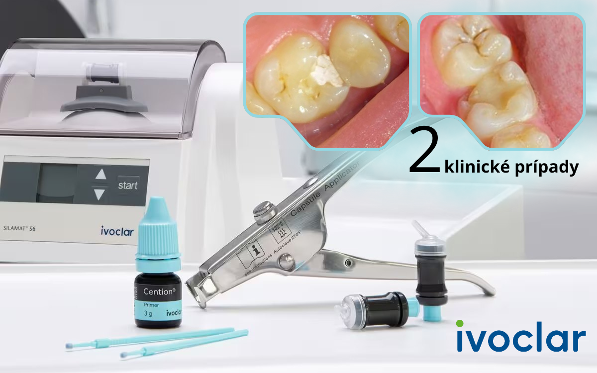 Keď rozhoduje čas na kresle: distálna výplň u mladého pacienta