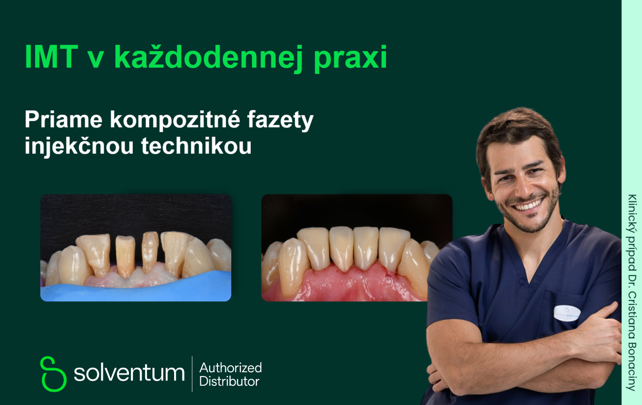 IMT - Priame kompozitné fazety injekčnou technikou