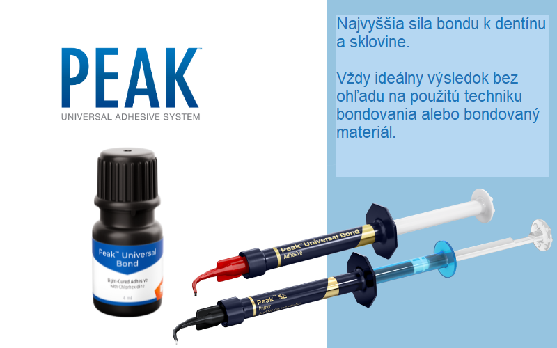 Spoľahlivé bondovanie