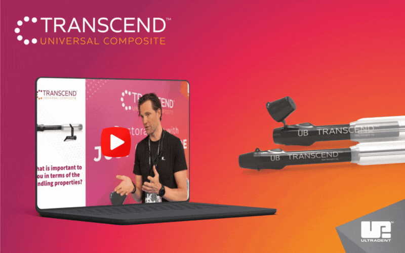 Myslím, že estetický výsledok aj leštiteľnosť sú naozaj, naozaj veľmi dobré.